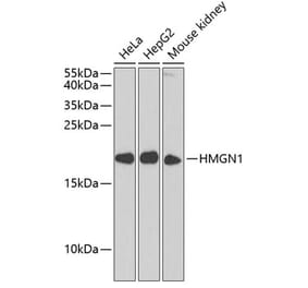 Western Blot - Anti-HMGN1 Antibody (A11925) - Antibodies.com