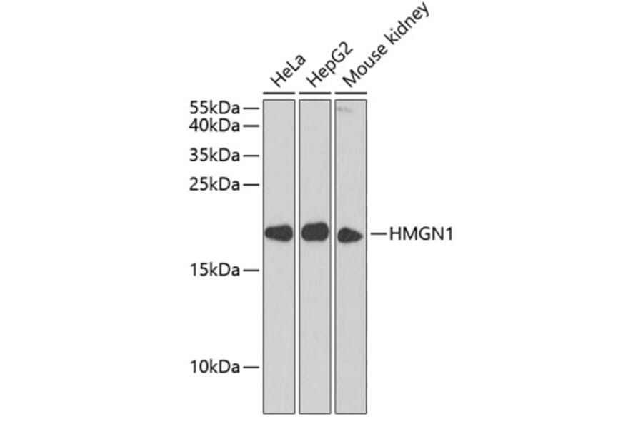 Western Blot - Anti-HMGN1 Antibody (A11925) - Antibodies.com