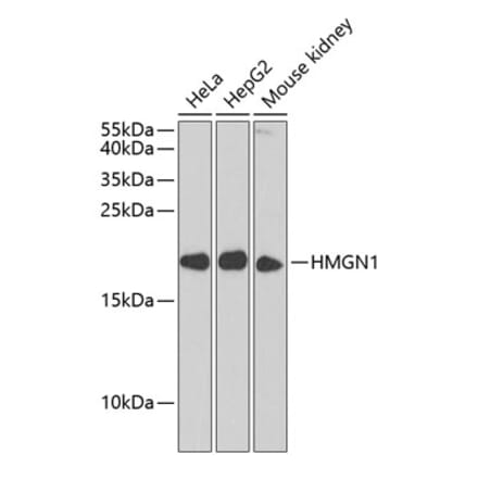 Western Blot - Anti-HMGN1 Antibody (A11925) - Antibodies.com