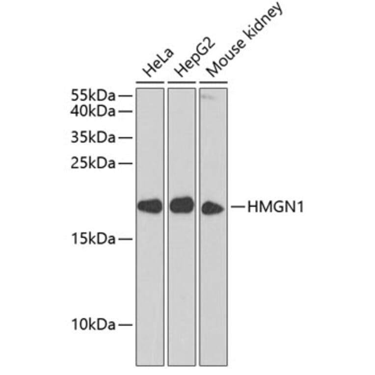 Western Blot - Anti-HMGN1 Antibody (A11925) - Antibodies.com