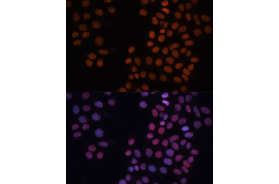 Immunofluorescence - Anti-HMGN1 Antibody (A11925) - Antibodies.com