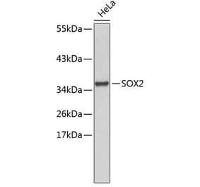 Western Blot - Anti-SOX2 Antibody (A11928) - Antibodies.com