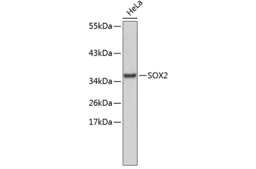 Western Blot - Anti-SOX2 Antibody (A11928) - Antibodies.com