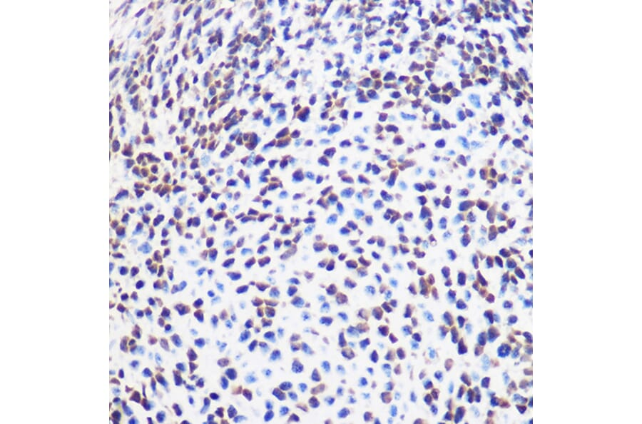Immunohistochemistry - Anti-SOX2 Antibody (A11928) - Antibodies.com