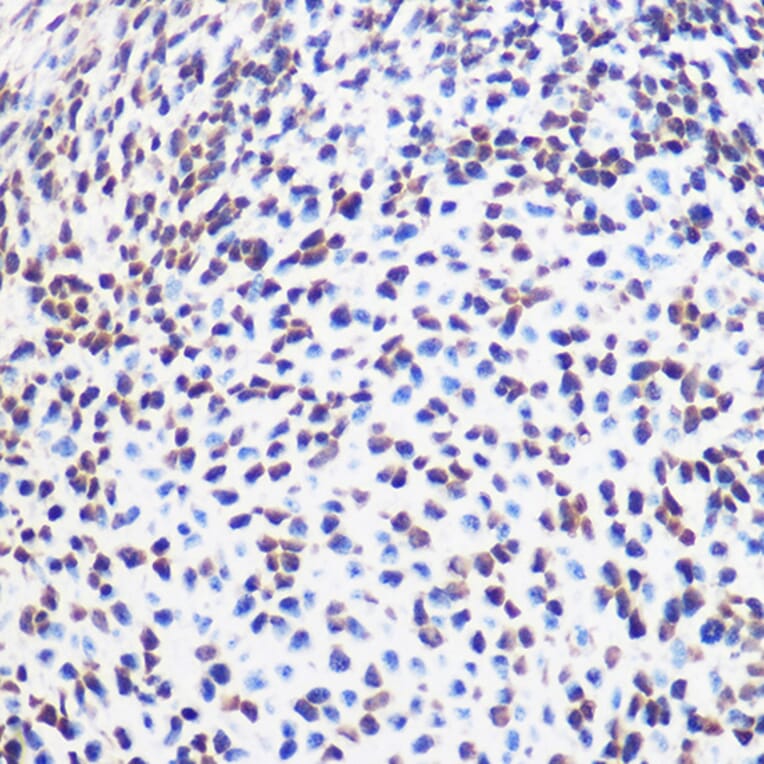 Immunohistochemistry - Anti-SOX2 Antibody (A11928) - Antibodies.com
