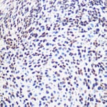 Immunohistochemistry - Anti-SOX2 Antibody (A11928) - Antibodies.com