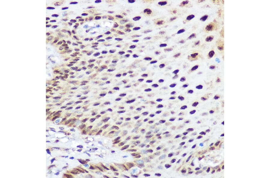 Immunohistochemistry - Anti-SOX2 Antibody (A11928) - Antibodies.com