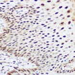 Immunohistochemistry - Anti-SOX2 Antibody (A11928) - Antibodies.com