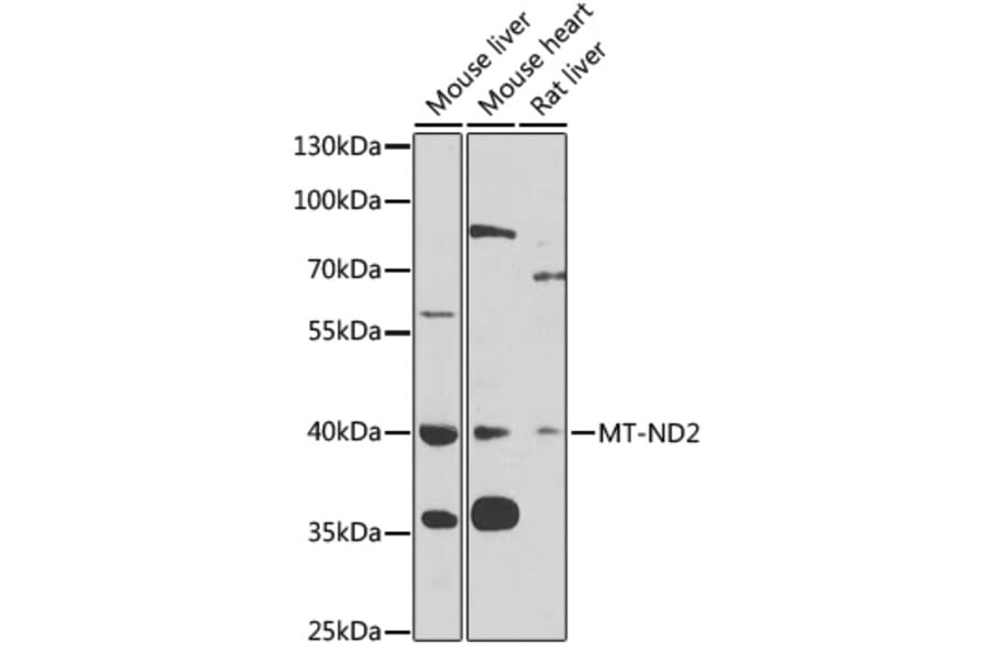 Western Blot - Anti-MT-ND2 Antibody (A11929) - Antibodies.com