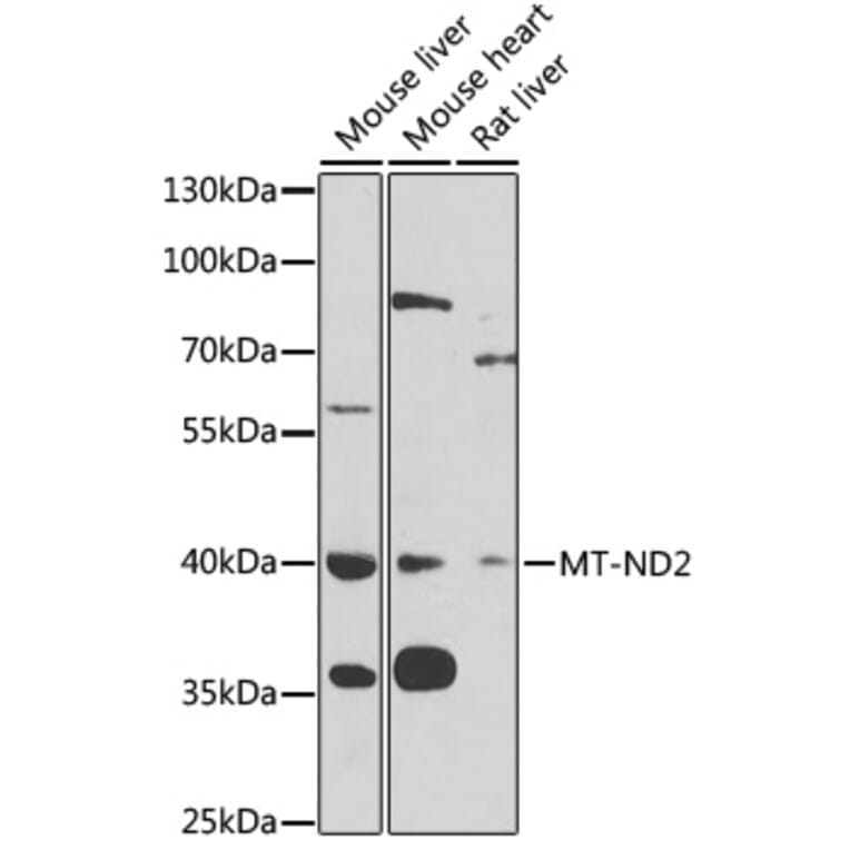 Western Blot - Anti-MT-ND2 Antibody (A11929) - Antibodies.com