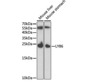 Western Blot - Anti-MD1 Antibody (A11930) - Antibodies.com