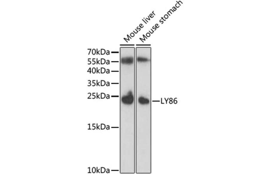 Western Blot - Anti-MD1 Antibody (A11930) - Antibodies.com