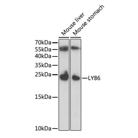 Western Blot - Anti-MD1 Antibody (A11930) - Antibodies.com