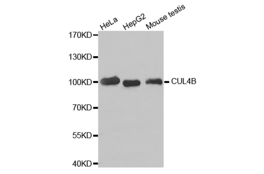 Western Blot - Anti-CUL4B Antibody (A6198) - Antibodies.com
