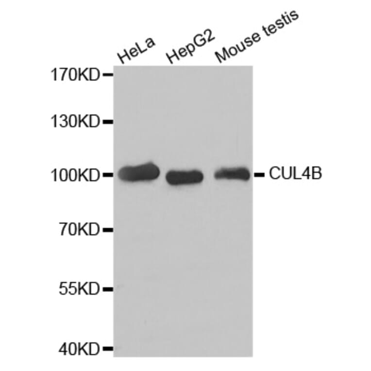 Western Blot - Anti-CUL4B Antibody (A6198) - Antibodies.com
