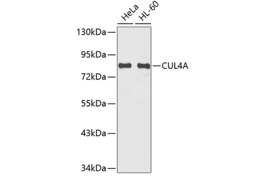 Western Blot - Anti-CUL4A Antibody (A6199) - Antibodies.com