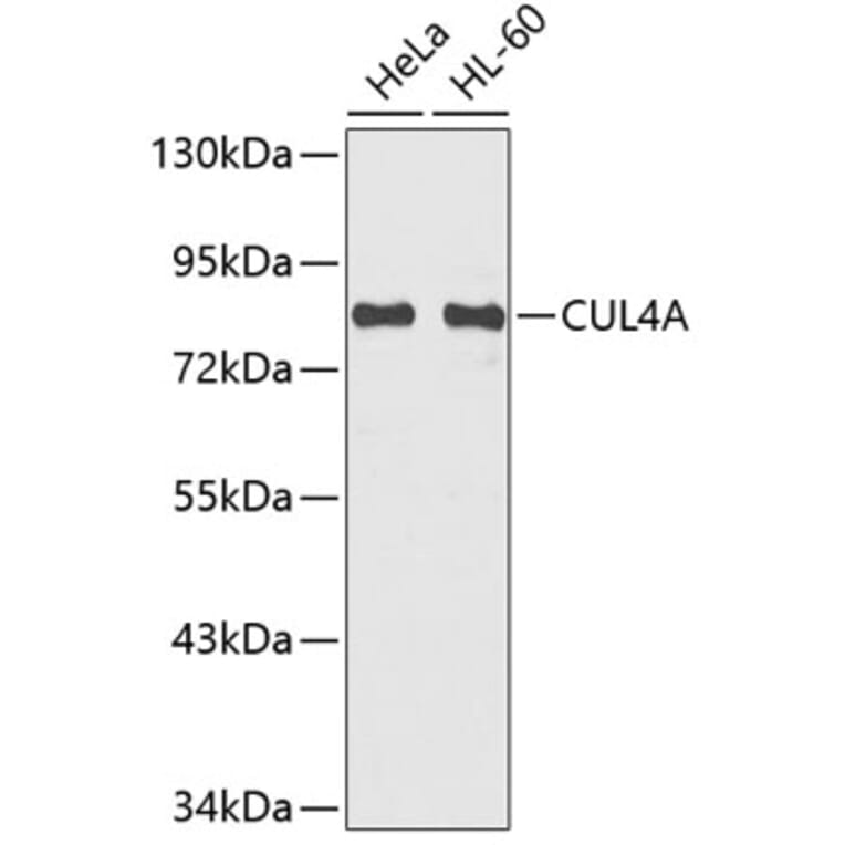 Western Blot - Anti-CUL4A Antibody (A6199) - Antibodies.com