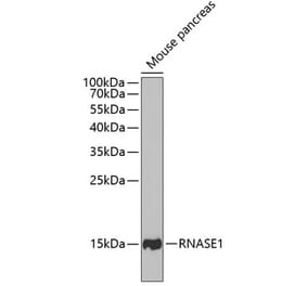 Western Blot - Anti-RNASE1 Antibody (A11933) - Antibodies.com