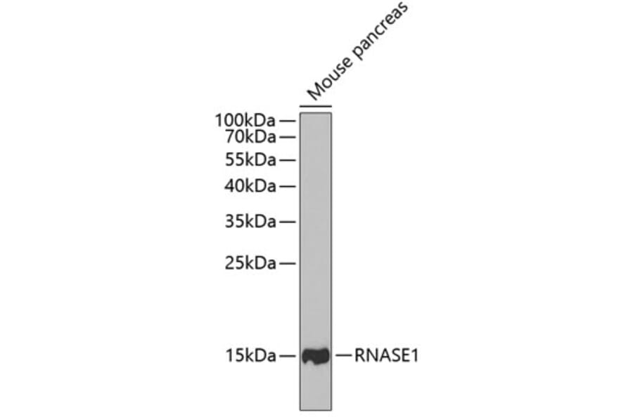 Western Blot - Anti-RNASE1 Antibody (A11933) - Antibodies.com