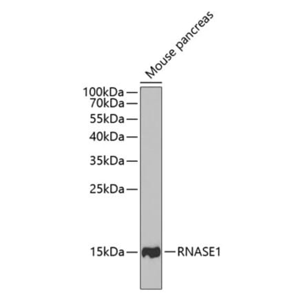 Western Blot - Anti-RNASE1 Antibody (A11933) - Antibodies.com