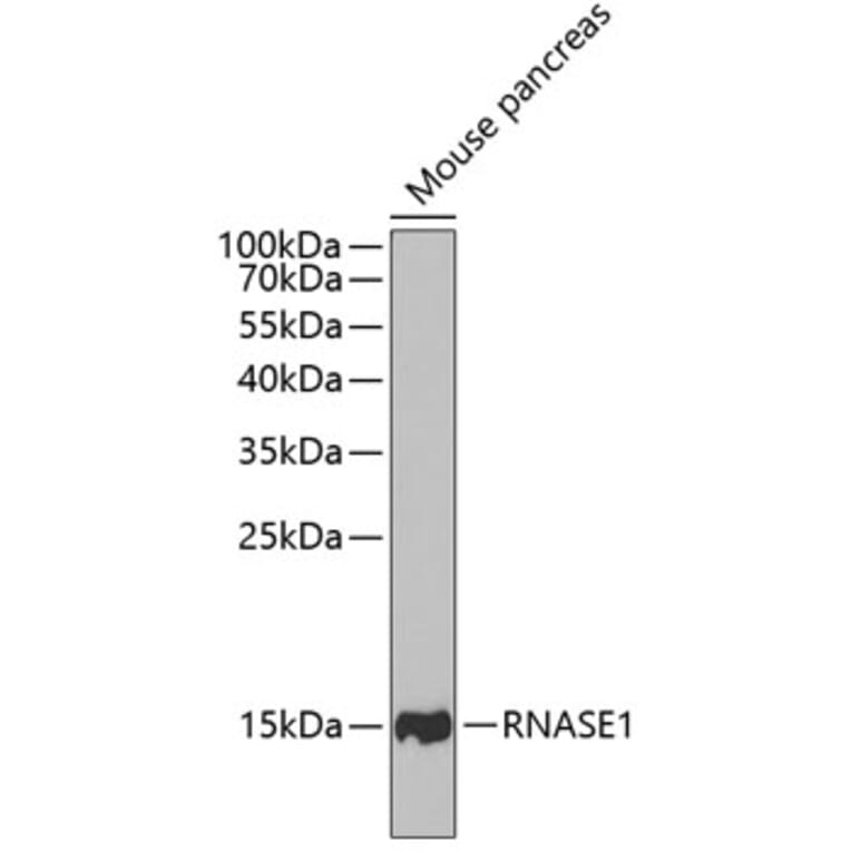 Western Blot - Anti-RNASE1 Antibody (A11933) - Antibodies.com