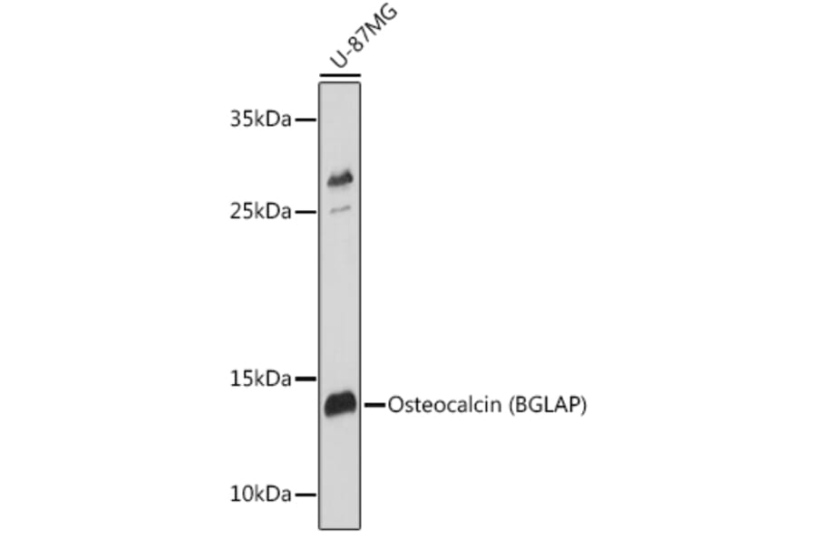 Western Blot - Anti-Osteocalcin Antibody (A11934) - Antibodies.com