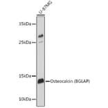 Western Blot - Anti-Osteocalcin Antibody (A11934) - Antibodies.com
