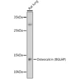 Western Blot - Anti-Osteocalcin Antibody (A11934) - Antibodies.com