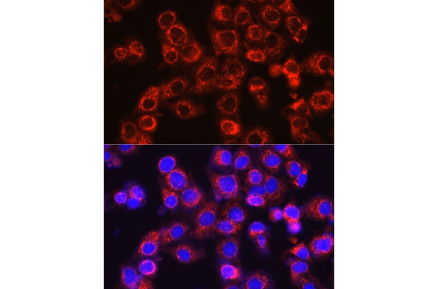 Immunofluorescence - Anti-Osteocalcin Antibody (A11934) - Antibodies.com