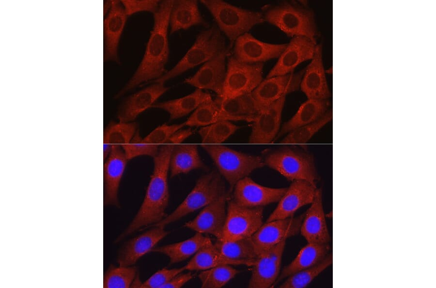 Immunofluorescence - Anti-Osteocalcin Antibody (A11934) - Antibodies.com