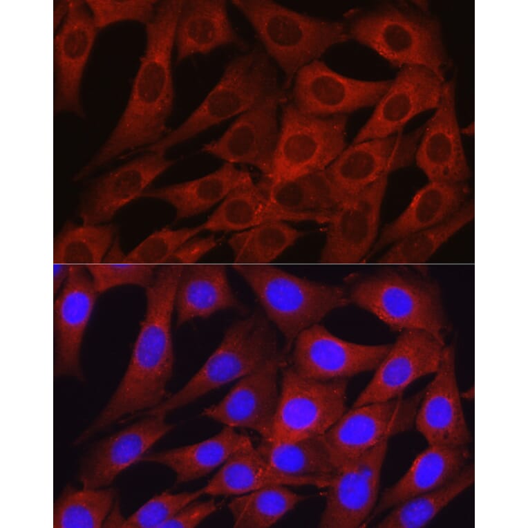Immunofluorescence - Anti-Osteocalcin Antibody (A11934) - Antibodies.com