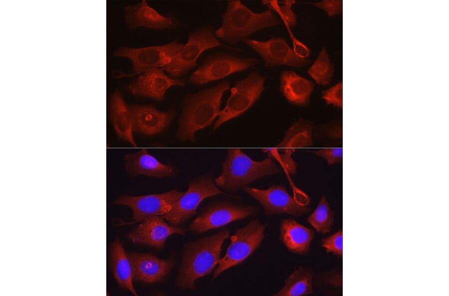 Immunofluorescence - Anti-Osteocalcin Antibody (A11934) - Antibodies.com
