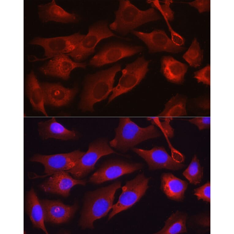Immunofluorescence - Anti-Osteocalcin Antibody (A11934) - Antibodies.com