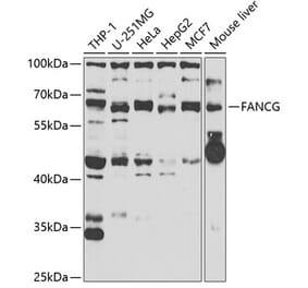 Western Blot - Anti-FANCG Antibody (A11935) - Antibodies.com