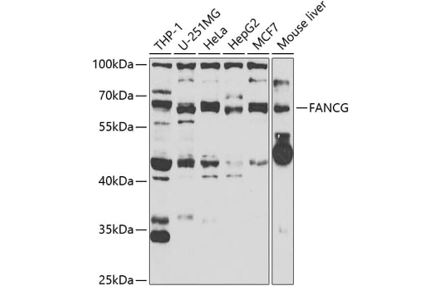 Western Blot - Anti-FANCG Antibody (A11935) - Antibodies.com