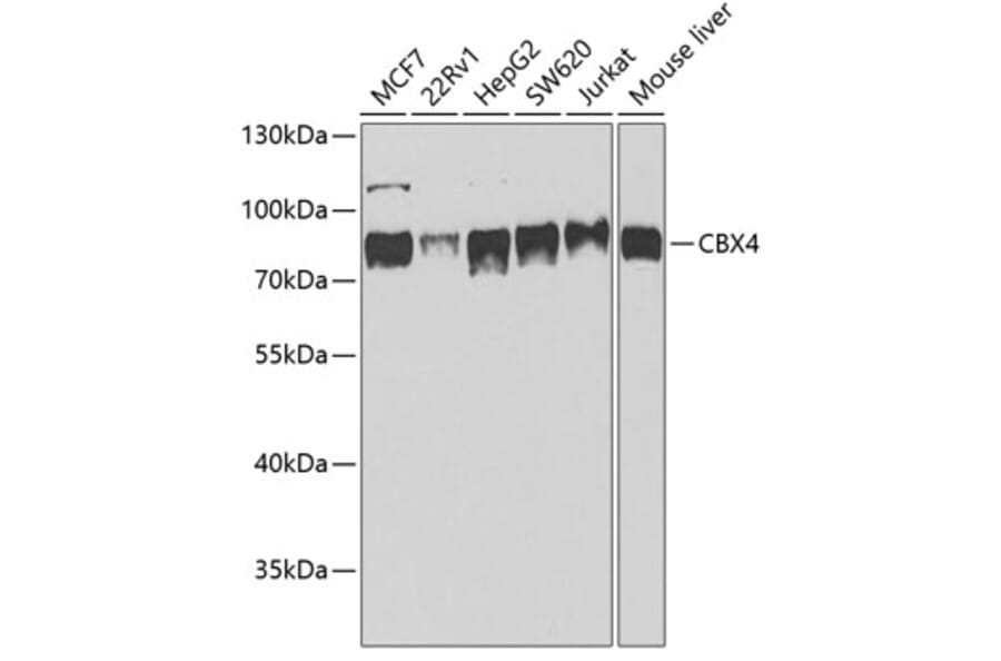 Western Blot - Anti-CBX4 Antibody (A6221) - Antibodies.com
