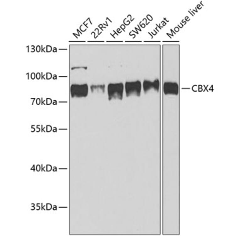 Western Blot - Anti-CBX4 Antibody (A6221) - Antibodies.com