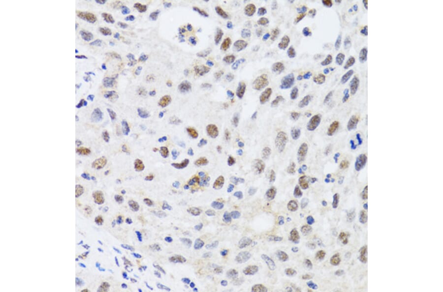 Immunohistochemistry - Anti-CBX4 Antibody (A6221) - Antibodies.com