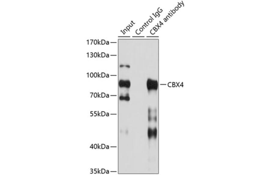 Immunoprecipitation - Anti-CBX4 Antibody (A6221) - Antibodies.com