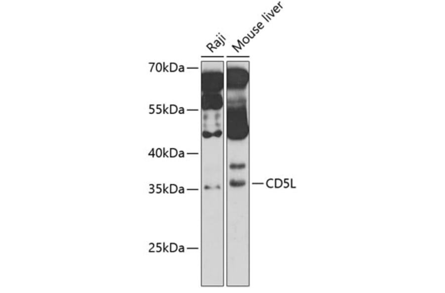 Western Blot - Anti-CD5L/CT-2 Antibody (A11937) - Antibodies.com