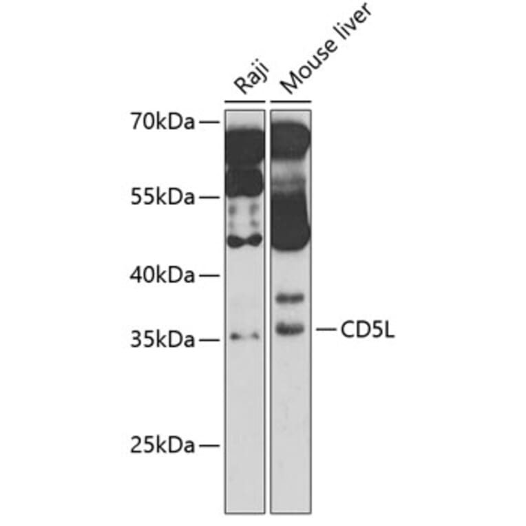Western Blot - Anti-CD5L/CT-2 Antibody (A11937) - Antibodies.com
