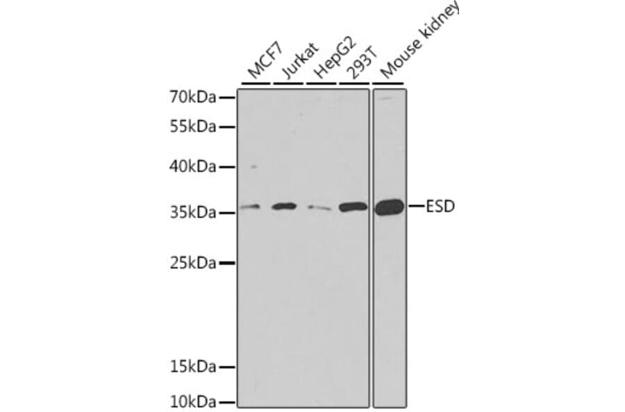 Western Blot - Anti-ESD Antibody (A11938) - Antibodies.com