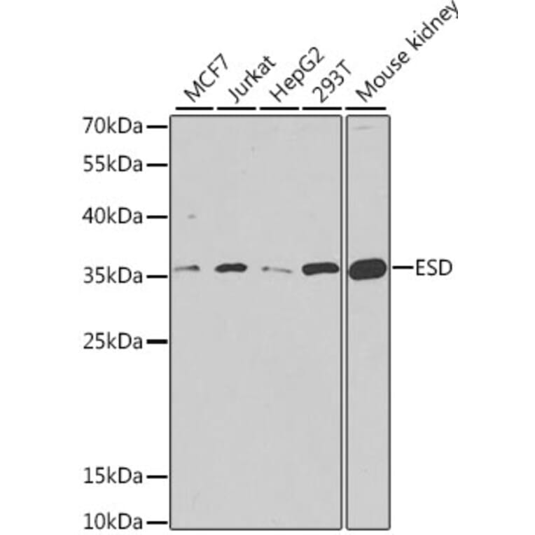 Western Blot - Anti-ESD Antibody (A11938) - Antibodies.com