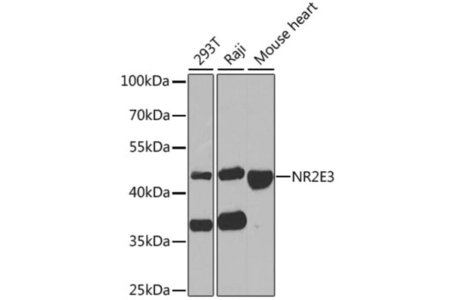 Western Blot - Anti-NR2E3 Antibody (A6234) - Antibodies.com