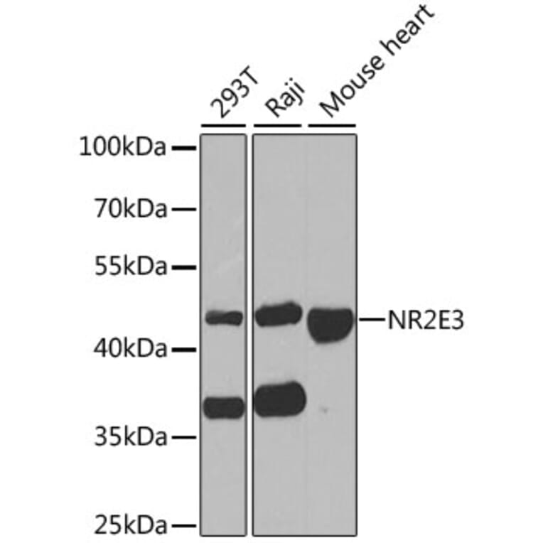 Western Blot - Anti-NR2E3 Antibody (A6234) - Antibodies.com