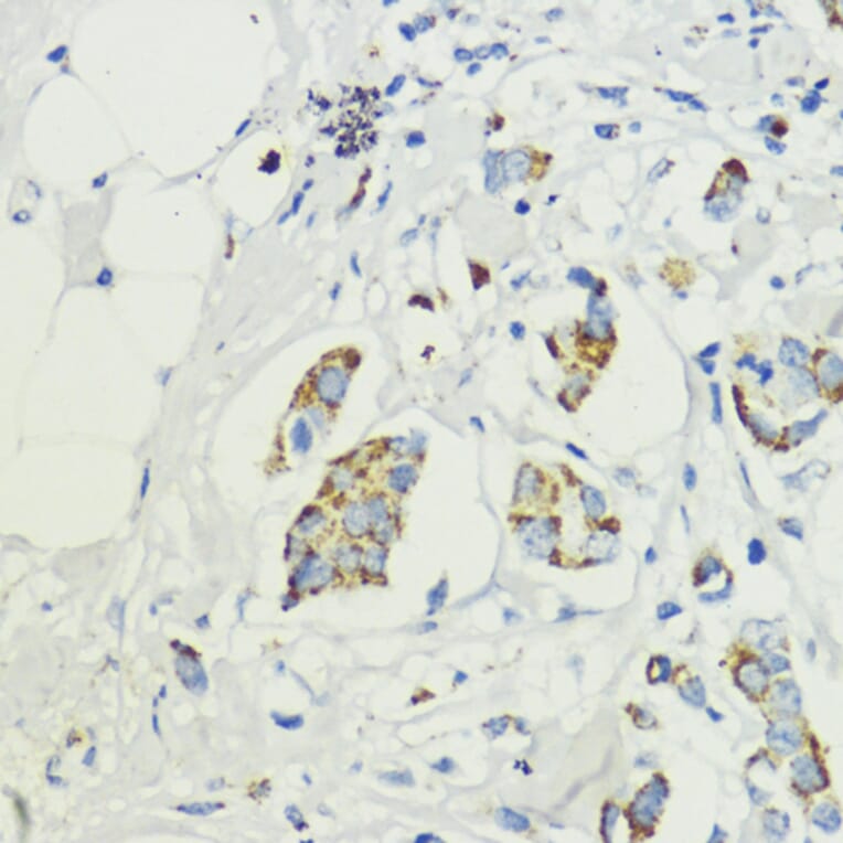 Immunohistochemistry - Anti-PRAS40 Antibody (A11941) - Antibodies.com