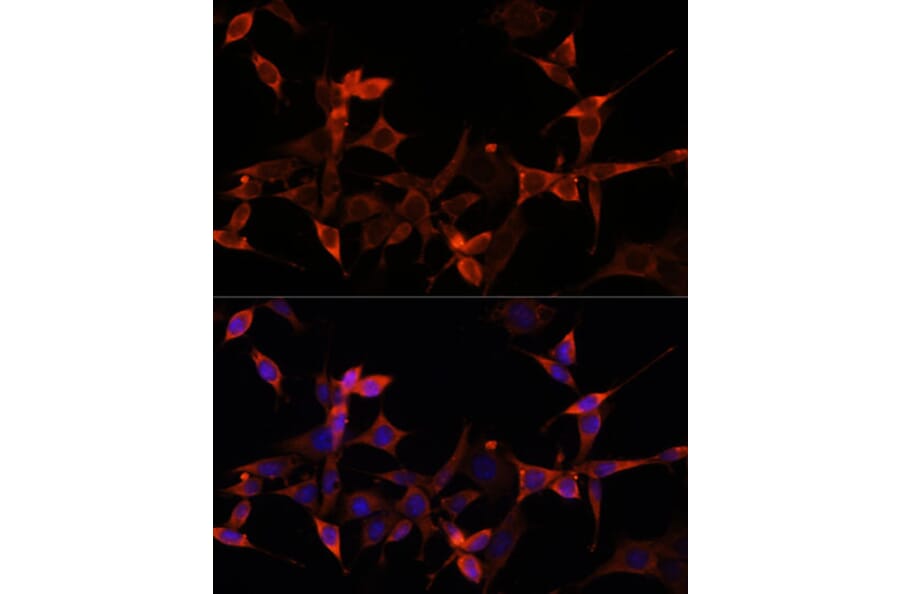 Immunofluorescence - Anti-PRAS40 Antibody (A11941) - Antibodies.com