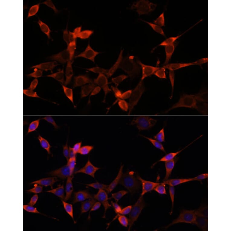 Immunofluorescence - Anti-PRAS40 Antibody (A11941) - Antibodies.com