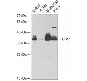 Western Blot - Anti-ETV7 Antibody (A11944) - Antibodies.com