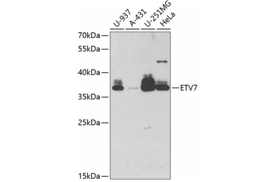 Western Blot - Anti-ETV7 Antibody (A11944) - Antibodies.com